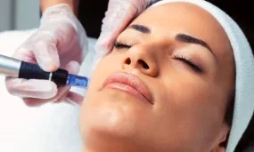 Microneedling Treatment for the Face & Neck Area at Face Magic